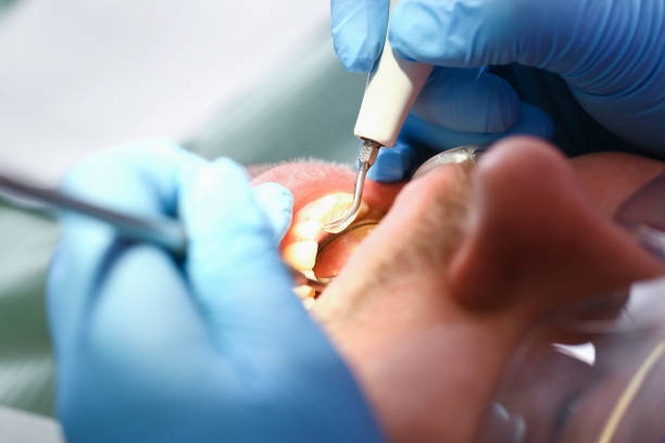 Best Weekend Emergency Dentist in Bluefield, VA