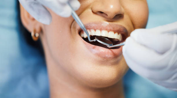 Best Emergency Wisdom Teeth Removal in Bluefield, VA
